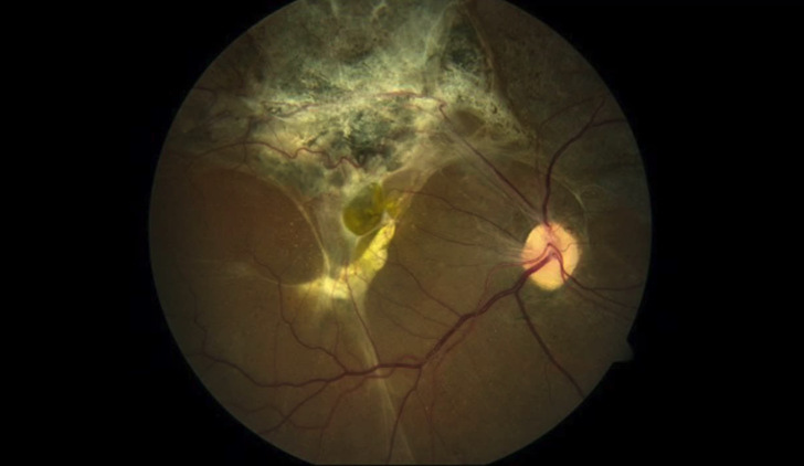 TraumaVideos