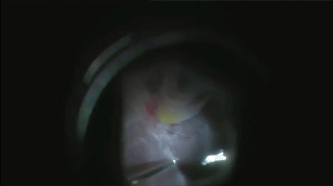 pvr-video-with-caption.png